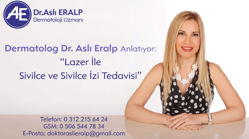 Lazerle Sivilce ve İz Tedavisi